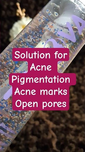 Acne cleanser Zenova by ‪@SkinEralifesciences‬ #shorts #acnetreatment #skincare #selfcare #acne