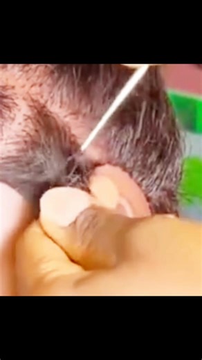 2.6K views · 24 reactions | New method dreadlock tutorial #fblifestyle #haircare #followers #everyone | sure Queen Hair | Facebook