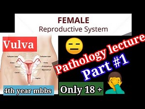 Special pathology lectures. Female Reproductive system part #1 Pathology for mbbs 4th year #vulva