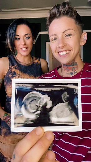 20 week scan #pregnancy #pregnant #scan #babymama