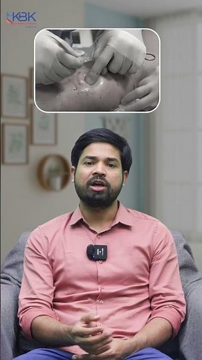 Mechanical Thrombectomy for DVT | Quick Blood Clot Removal Explained | KBK Hospitals