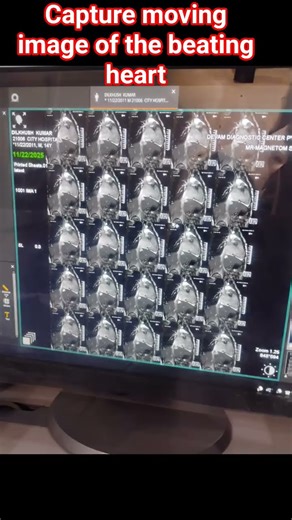 mri cardiac imaging #soundef #sound #radiography
