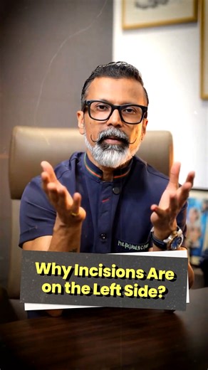 Dr Atul N.C. Peters on Instagram: "“Doctor, did you forget my appendix is on the right? Why are the cuts on the left?” I hear this all the time 😄 But no — we haven’t forgotten anything. In laparoscopic and robotic appendicectomy, the instruments enter from the opposite side for accuracy and ease. Right side appendix. Left side incisions. Perfectly normal. #Appendicectomy #RoboticSurgeryIndia #SurgeryFacts #DrAtulPeters #MinimallyInvasiveSurgery"