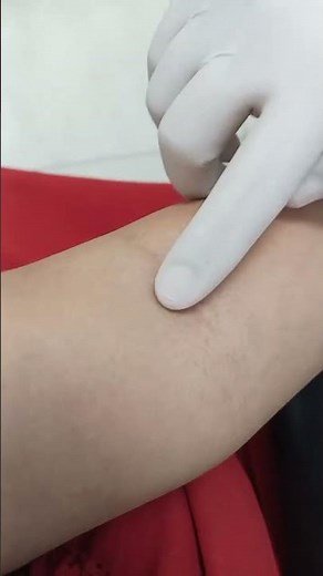 Blood Collection in Tube | Step-by-Step Phlebotomy Guide #BloodCollection #Phlebotomy