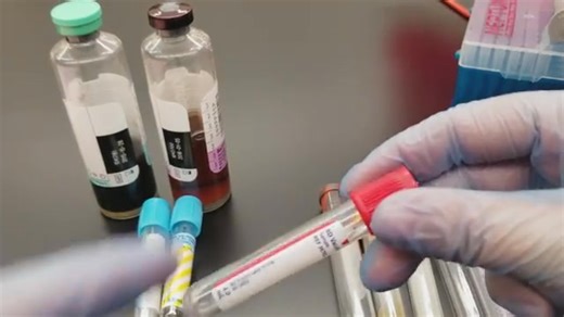 7.5K views · 232 reactions | Order of draw❤️❤️ #lablife #hematology | Lab life | Facebook