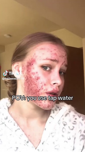 Clean water is all you needed🤫 #helios #heliosfilter #waterfilter