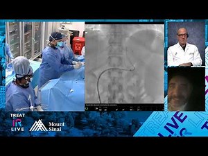Balloon-Occluded Retrograde Transvenous Obliteration of Gastric Varices (BRTO)