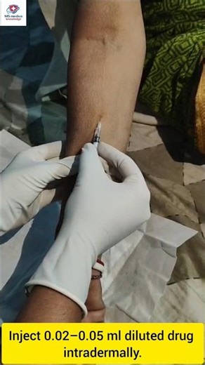 💉Intradermal Skin test procedure 🧬