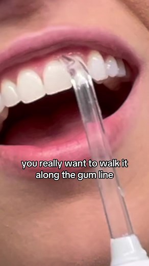 Water flossers are great at stimulating your gums, removing debris from your teeth, and… MAKING A MESS IN YOUR BATHROOM? Let’s fix that by making sure you’re using it properly! By using it properly, you will no longer make a mess in your bathroom :) Full tutorial video on YouTube.com/TeethTalk ☮️❤️🦷 #waterflosser #waterpik #dentalfloss #floss #dentalhygiene #cleanteeth #oralcare #dentalcare #dentalhygienist #rdh #healthyteeth #dental