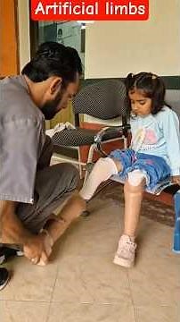 A Brave Little Girl's First Steps with Double Below-Knee Prosthetic Legs ❤️ | Inspiring Journey