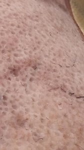 Aperitiv | Outdoor Cooking Adventure