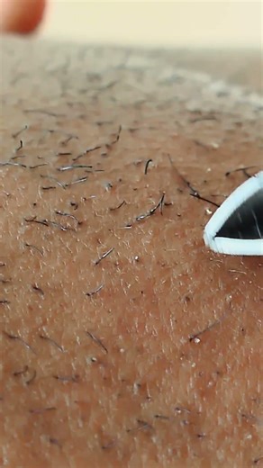 Between Hair and Hand The Beard Plucking Experience13