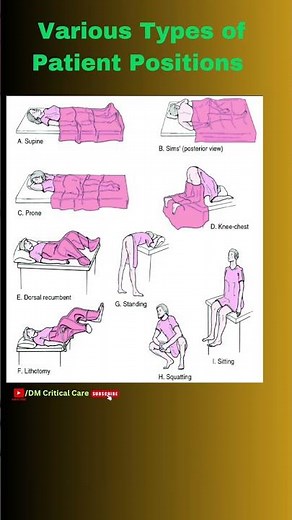 Various Types of Patient Positions!! Medical Patients Positions | Positions of Pt. #patientpositions