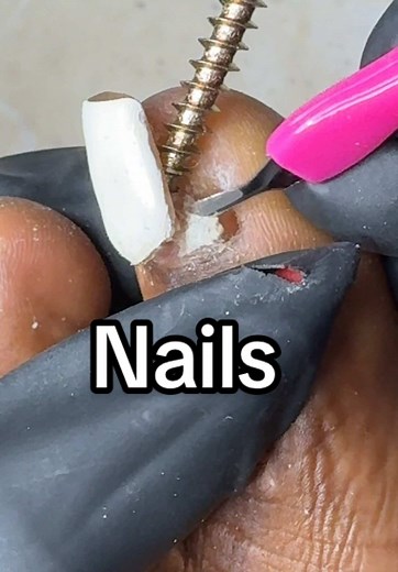 Easy Acrylic Nails Removal Tips and Techniques
