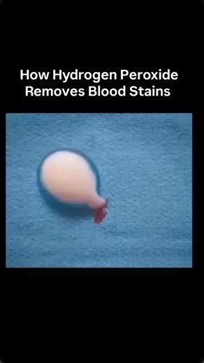 Uni-verse on Instagram: "Hydrogen peroxide (H202) removes blood stains through oxidation, where its active oxygen molecules break down hemoglobin and proteins in the blood. Upon contact, the enzyme catalase in blood causes the peroxide to bubble, which physically lifts the stain from fabric fibers. It is most effective on fresh stains when applied directly, allowed to fizz for several minutes, then rinsed with cold water. best results, it is often recommended to blot the stain, rinse with cold w