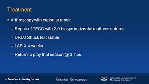 Arthroscopic Capsular Repair for Foveal TFCC Tear