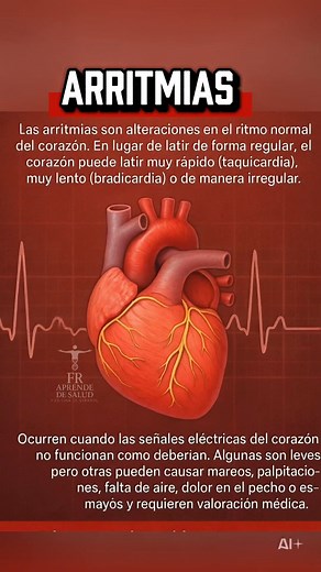 Las arritmias son cambios en el ritmo del corazón que pueden hacerlo latir muy rápido, muy lento o de forma irregular. Si dan mareos, dolor en el pecho o desmayos, es urgente consultar. #Arritmias #RitmoCardiaco #SaludDelCorazon #HeartHealth #Cardiology #Medicina #HealthEducation | Aprende de salud , learn about health