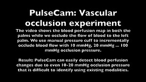 Incremental vascular occlusion
