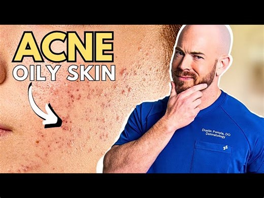 Struggling With Oily Skin? Here’s What Dermatologists Say You Should Do