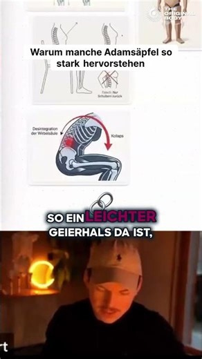 Warum manche Adamsäpfel so stark hervorstehen