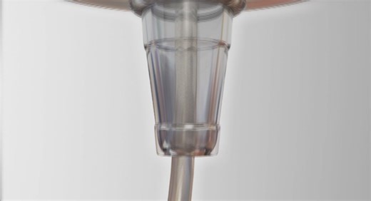 New cholesterol procedure is 'major game changer'