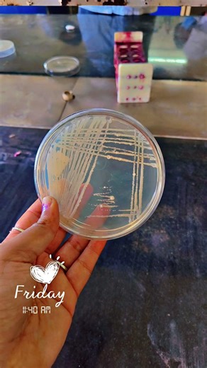 4th Quadrant Streaking #LabWork#CulturePlates#BacterialCulture#PetriDish#AsepticTechnique#StreakPlat