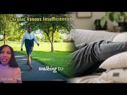 Chronic Venous Insufficiency: What You Need to Know