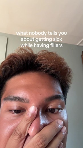 Getting Sick with Fillers: What Nobody Tells You