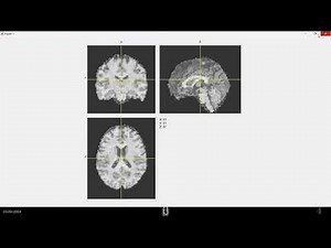E3 | Read and see MRI images in MATLAB | Nifti files | Basics of MATLAB for MRI/fMRI
