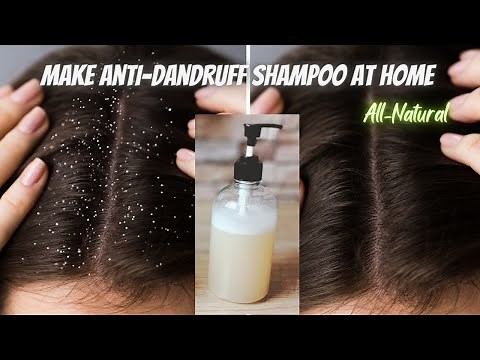 Flake-Free, Healthy Scalp | DIY Anti-Dandruff Shampoo | Easy & Natural