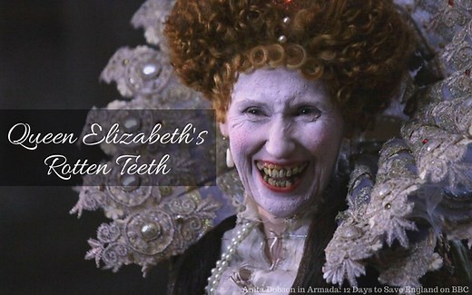 Queen Elizabeth's Rotten Teeth - Tudors Dynasty