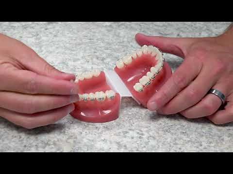 How To Use Dental Wax