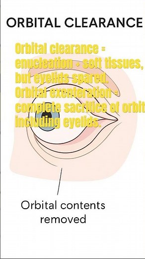 ORBITAL CLEARANCE//ORBITAL EXENTERATION