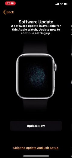 Unable to Check for Update. Pairing New Apple Watch Problem [PART 1]