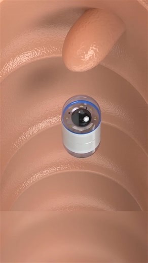 Camera Capsule 😲