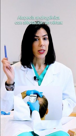 ¿Cuáles son los tipos de alopecia que existen? Diagnóstico express con nuestra doctora Amaro👩‍⚕️