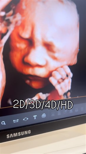 New Life Ultrasound®️ on Instagram: "The difference between 2D/3D/4D/HD 👶🏻👶🏻👶🏻"