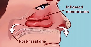 How to clear your sinuses with nothing but your fingers | Stunning Videos