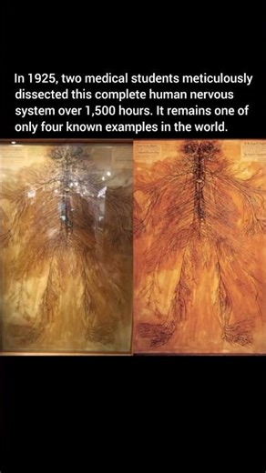 Only 4 Exist A Complete Human Nervous System.