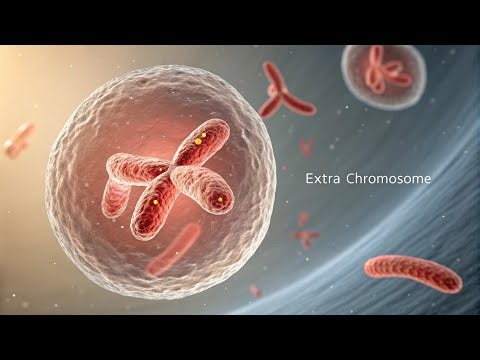 You Might Have an Extra Sex Chromosome and Not Even Know It