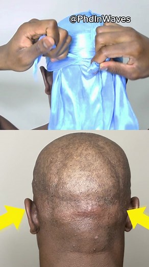 Be Careful How Tight You Tie Your Durag #360waves #durag #haircare #scalp #barber