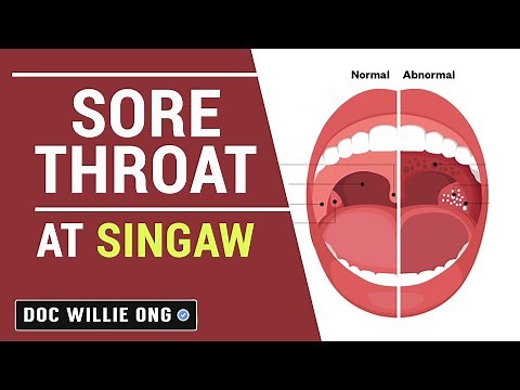 Sore Throat at Singaw - ni Doc Willie at Liza Ong #290b