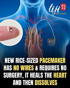 BREAKING MEDICAL NEWS: A Pacemaker That Heals Your Heart… Then...