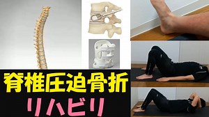 脊椎椎体骨折圧迫骨折についてのご紹介と椎体形成術という手術、リハビリテーションについて解説