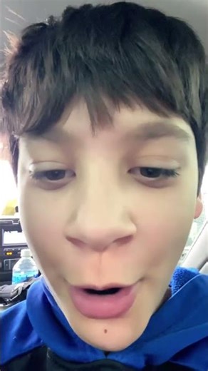 Where zooming into our hair😇