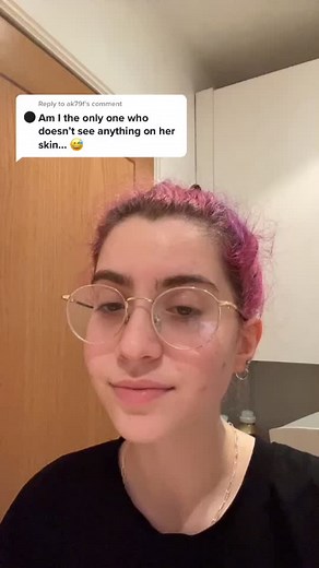 Reply to @ak79f my acne used to be a lot worse but after seeing a dermatologist and getting a good skincare routine i only get flare ups now :)