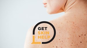 Inspiring Stories by Patients