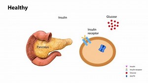 Actividad de la insulina y diabetes tipo 1 y 2, animación 2d 3d, rencor, enfermedades metabólicas, enfermedad pancreática, receptores de insulina, páncreas