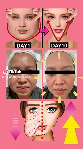 What is Mesotherapy? Understanding the Technique and Benefits