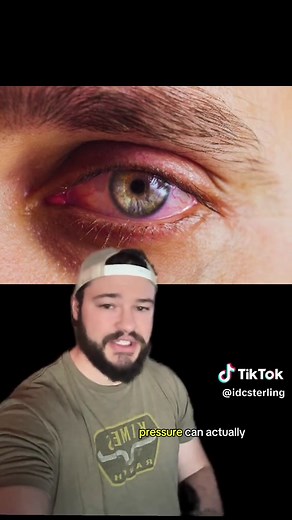 Understanding Sneezes: Causes and Remedies